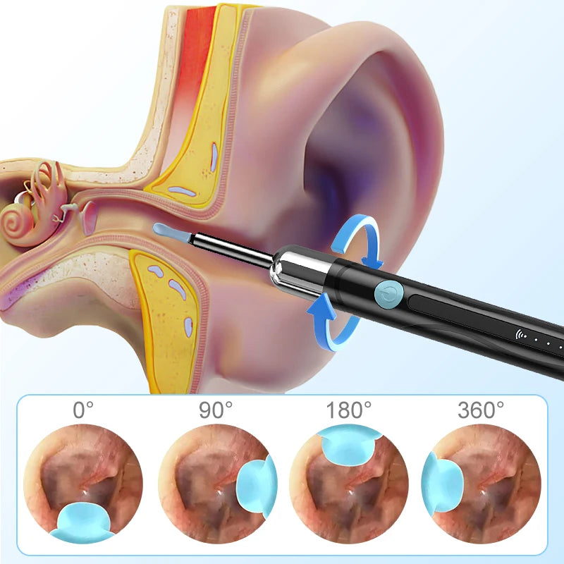 Endoscope Smart Visual Ear Wax Scooper